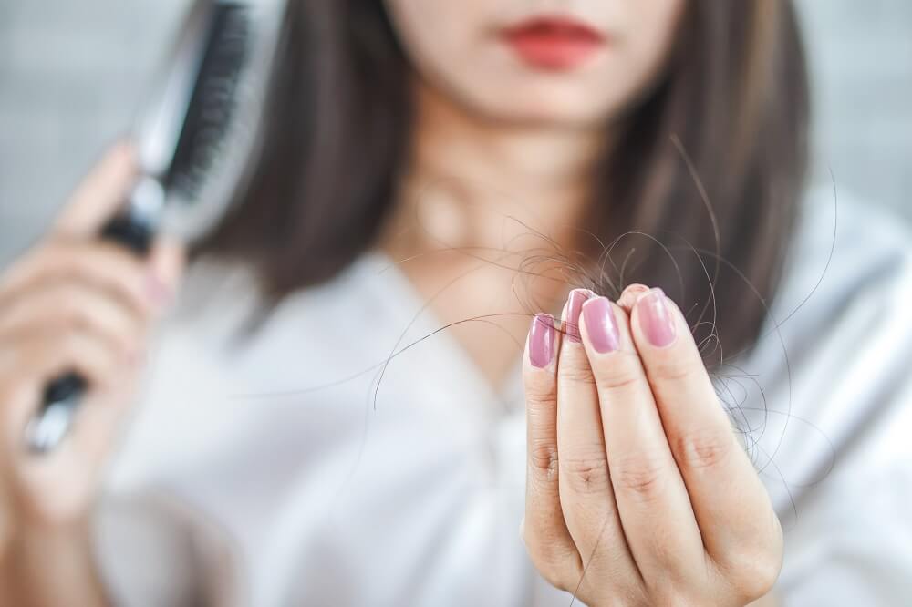 Alopecia femminile